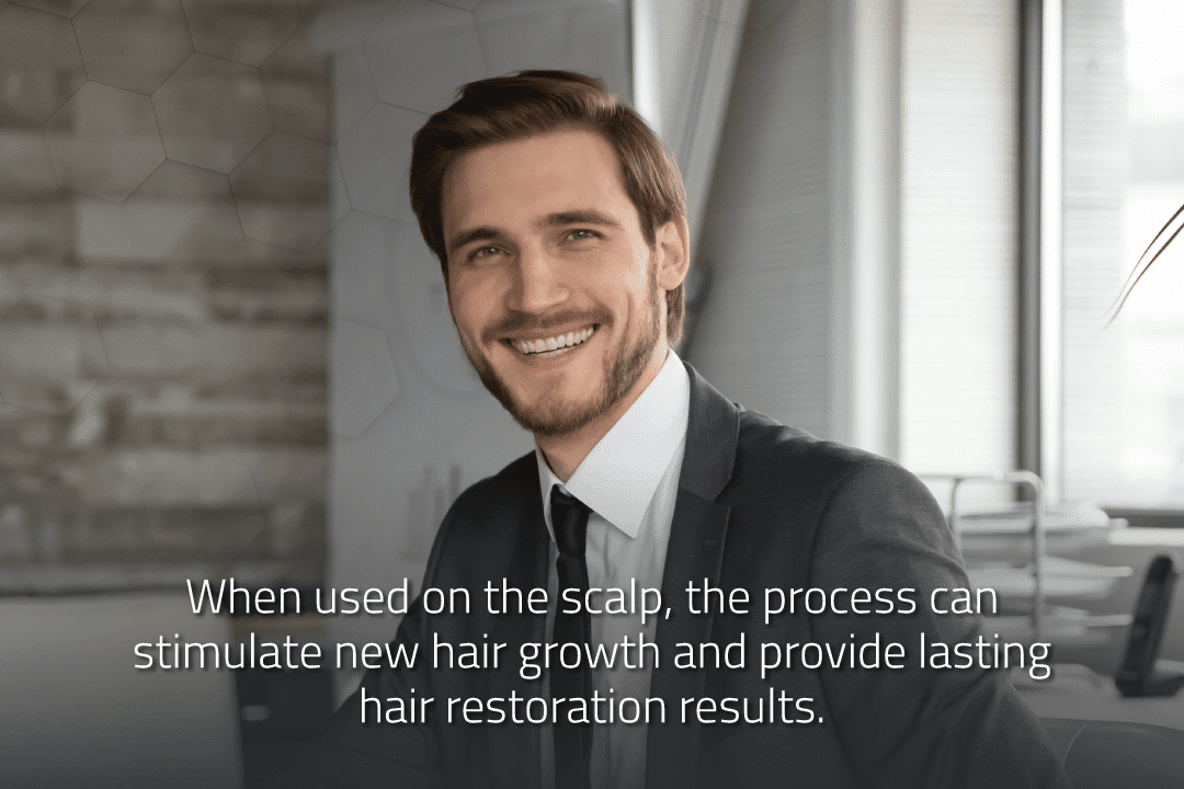 What are PDO Threads for Hair Growth?