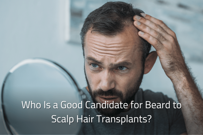 Who Is a Good Candidate for Beard to Scalp Hair Transplants?