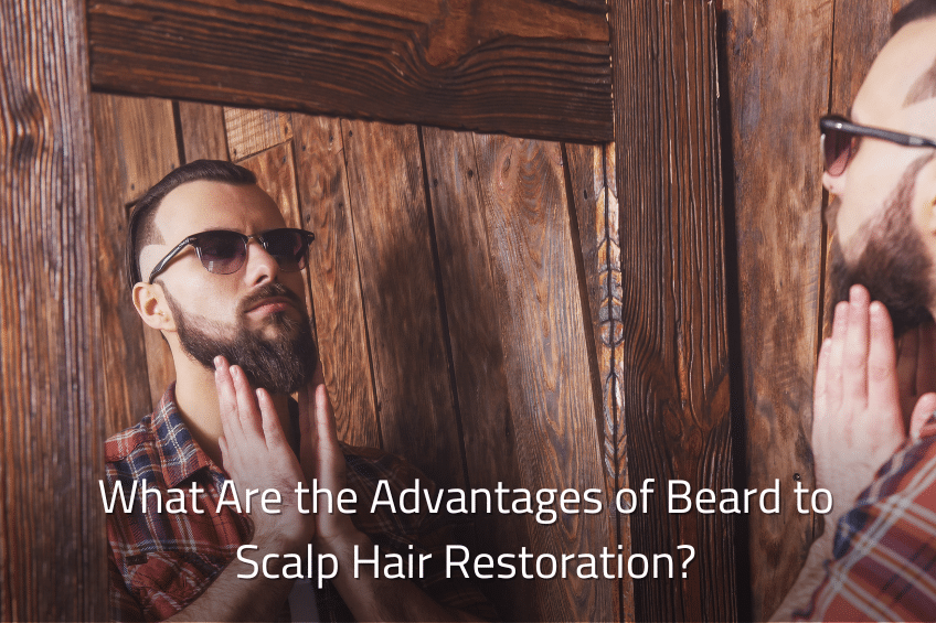What Are the Advantages of Beard to Scalp Hair Restoration?