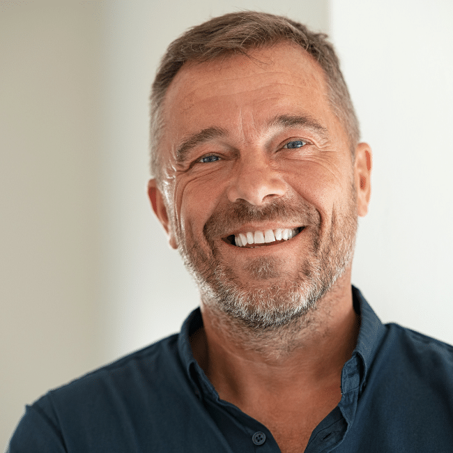 What to Expect After a Hair Transplant