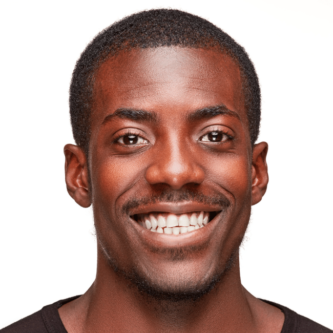 Must-Ask Questions Before Booking Your Hair Transplant