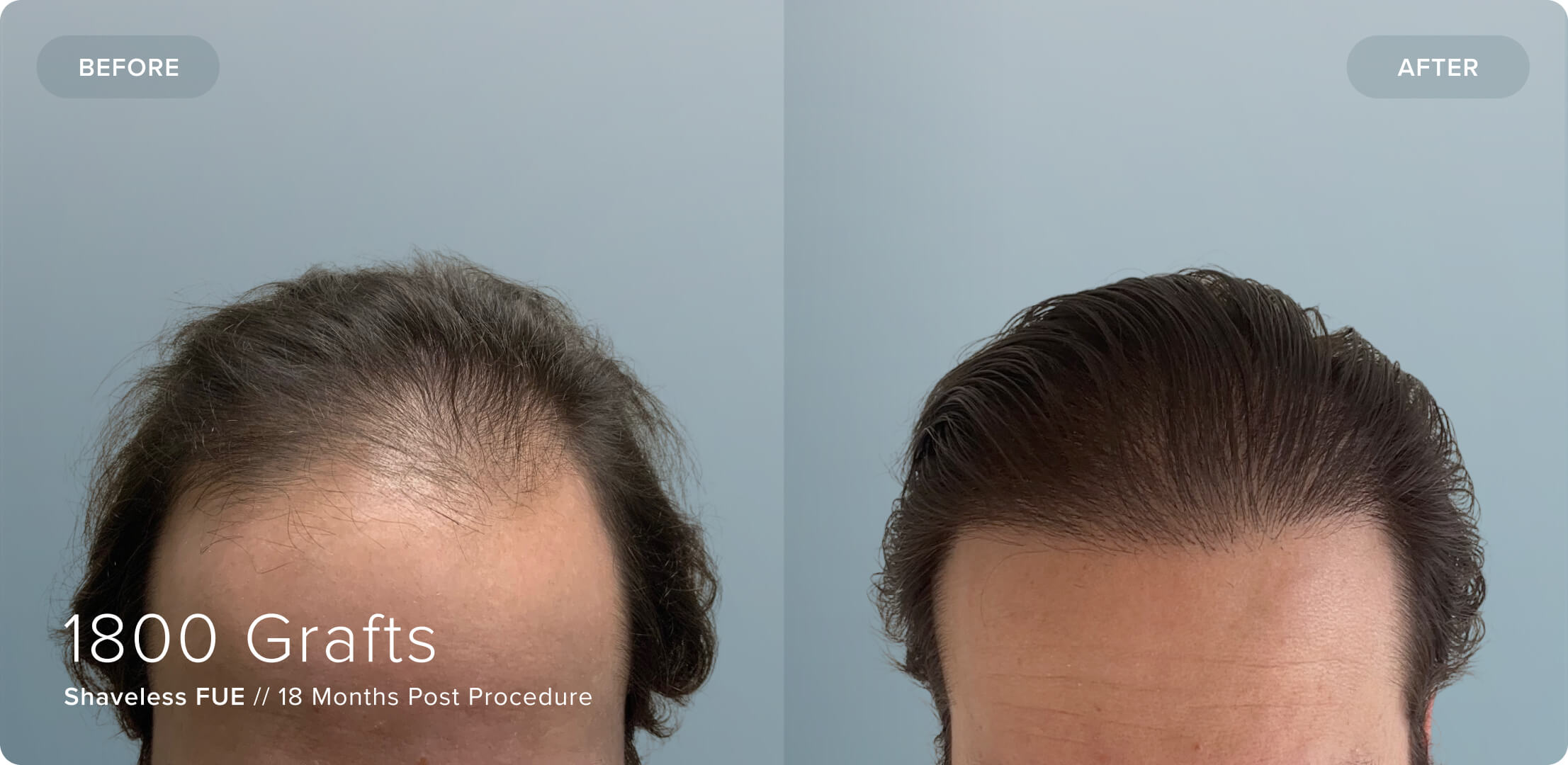 Shaveless_JL_Results