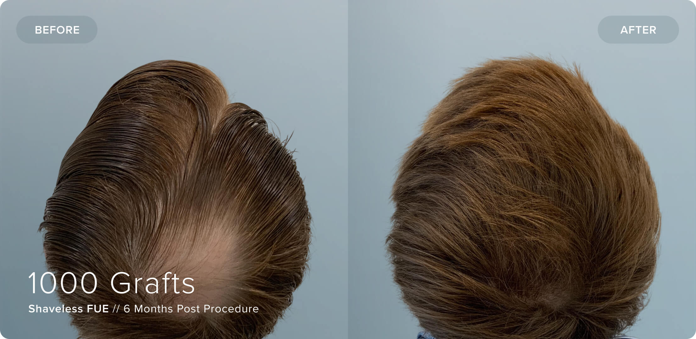 Shaveless_RS_Results