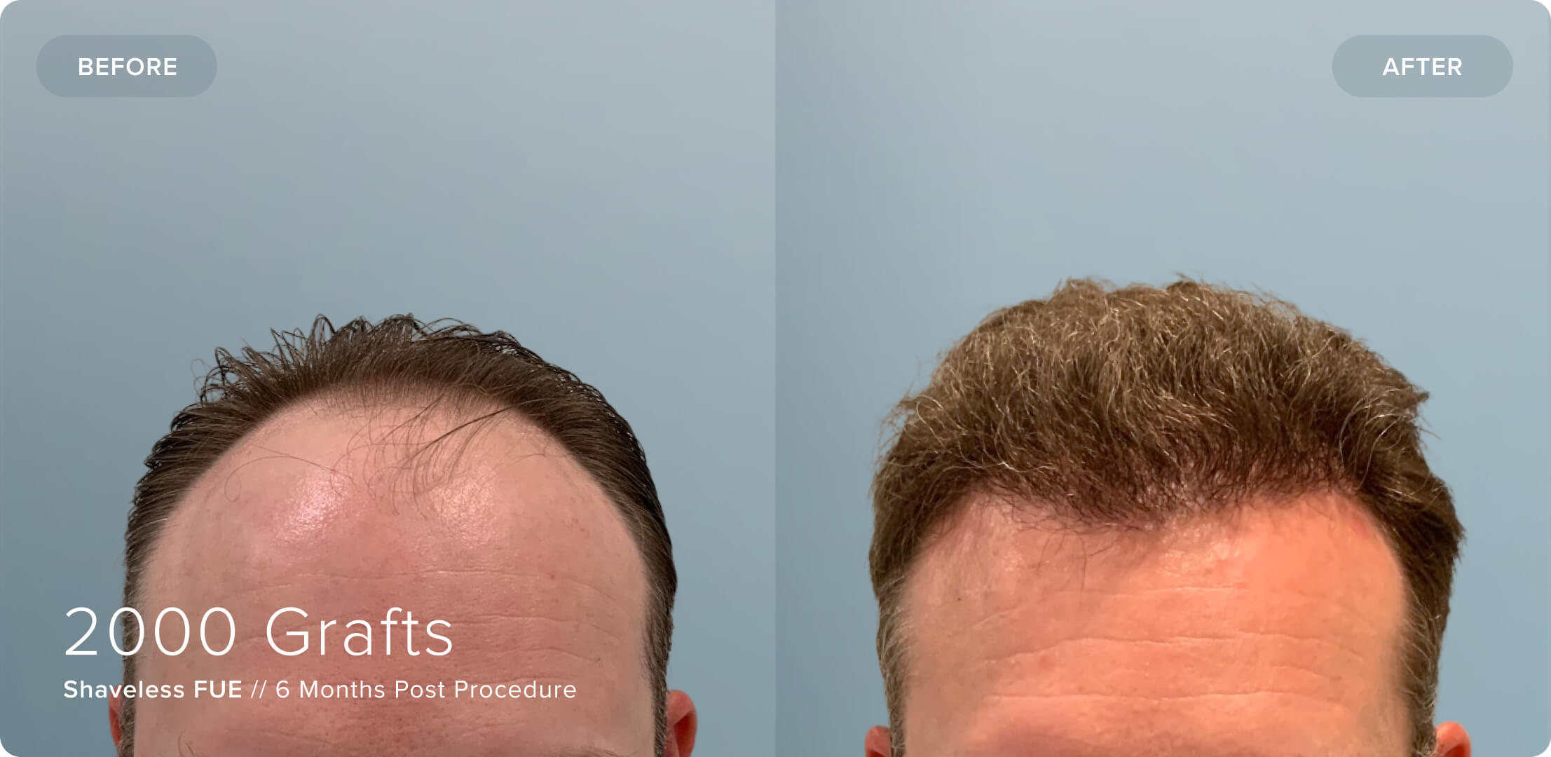 Shaveless_SW_Results