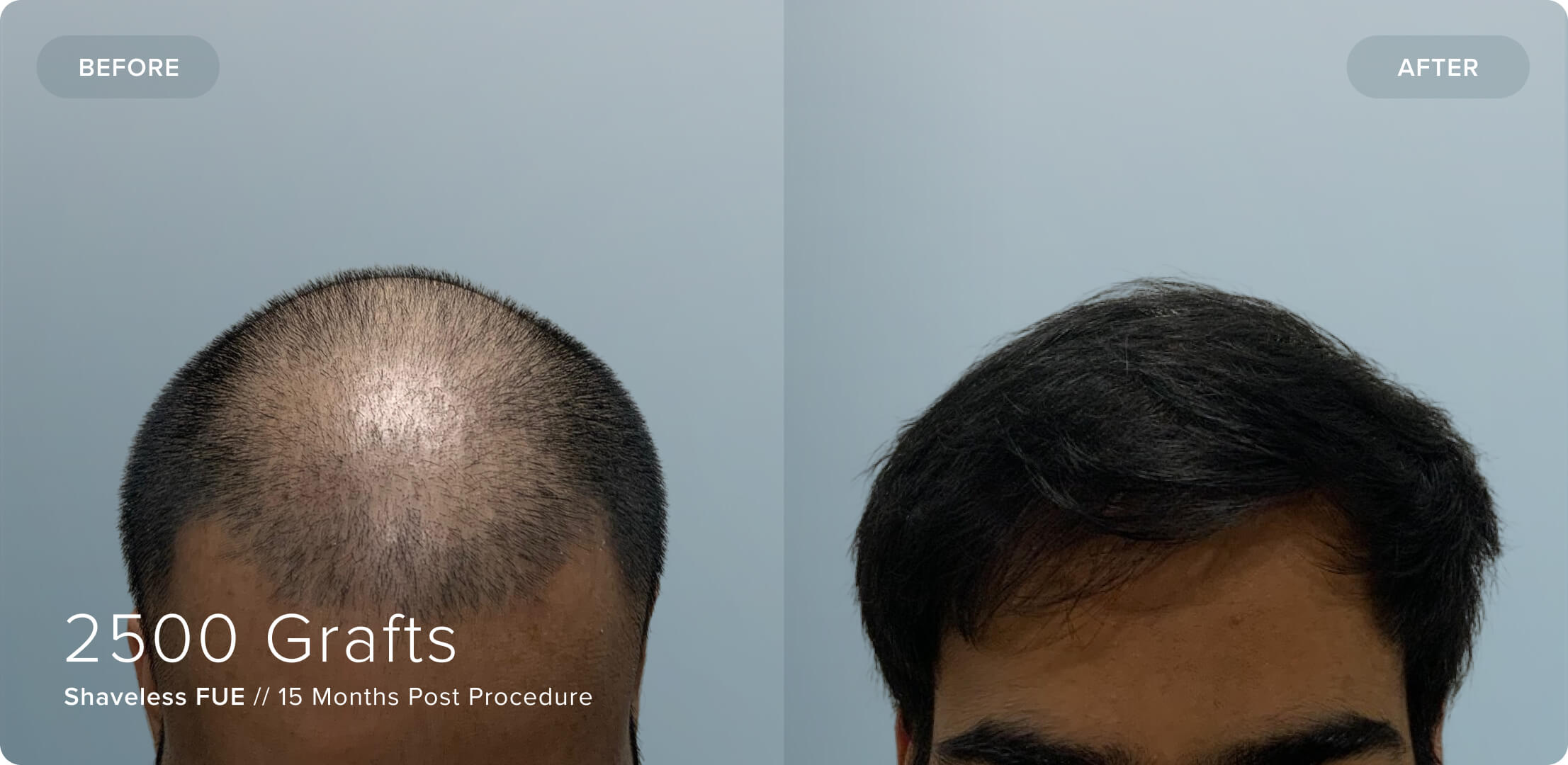 Shaveless_VR_Results