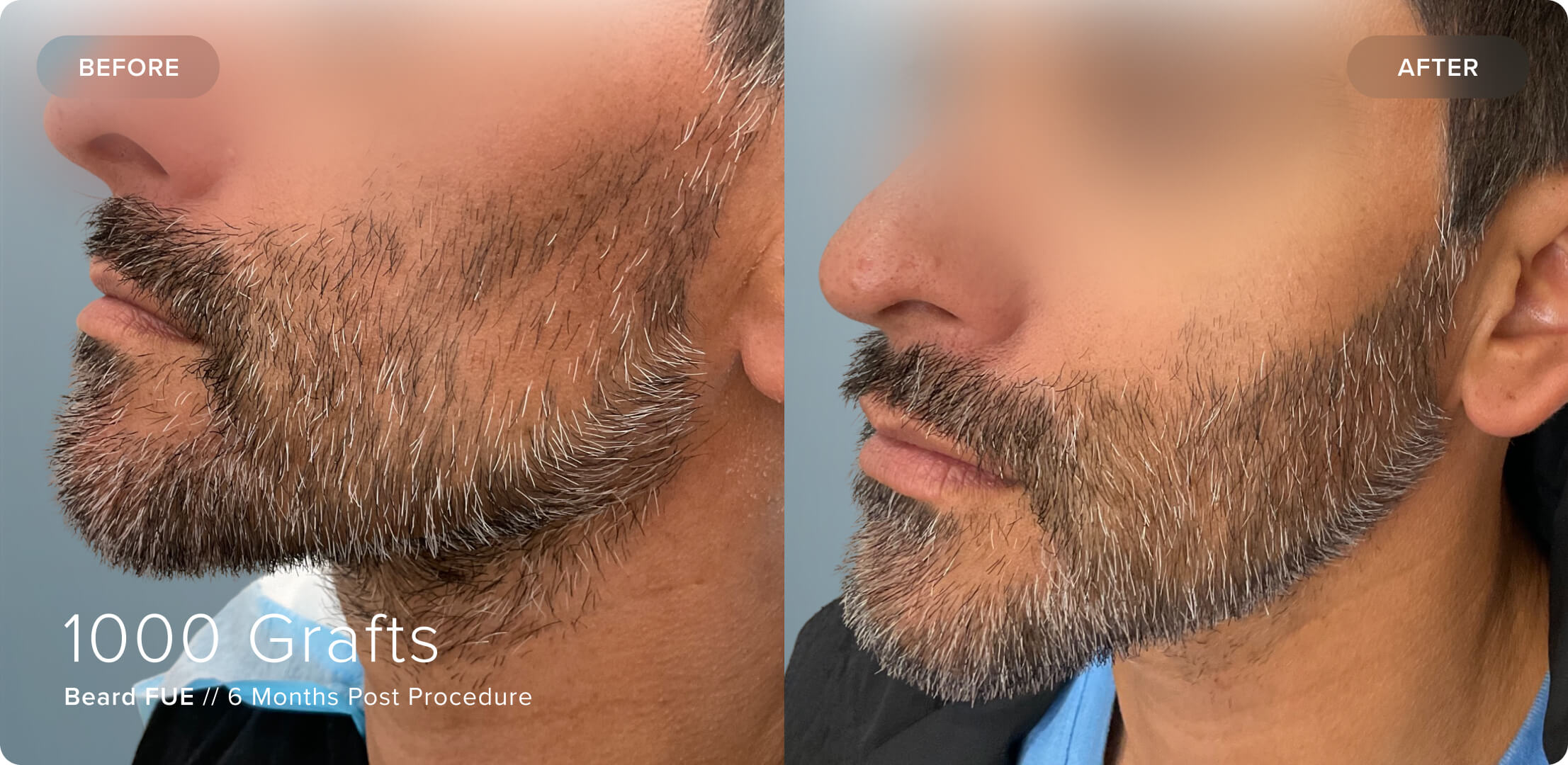 Beard_HT_Results