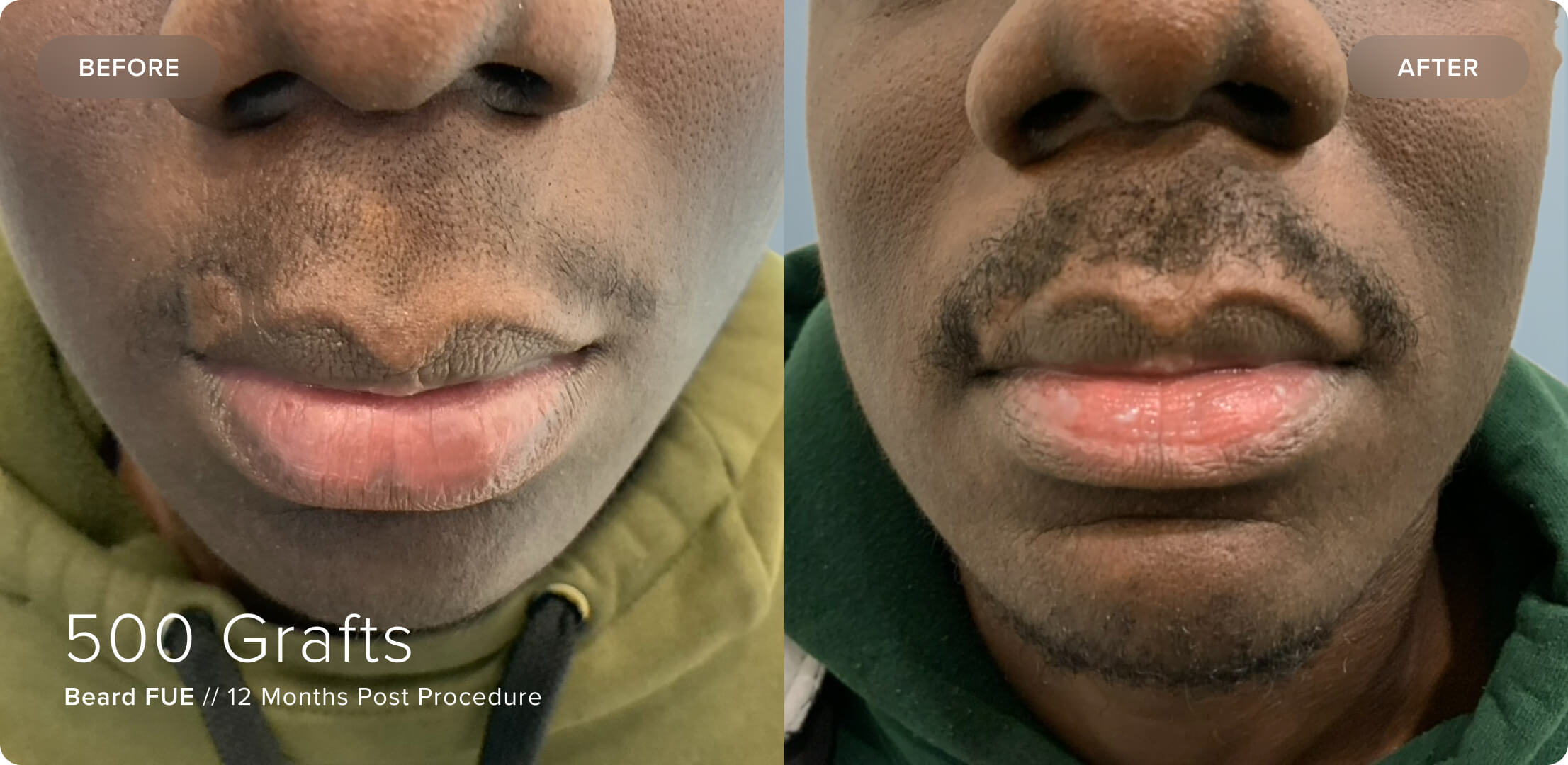 Beard_JR_Results