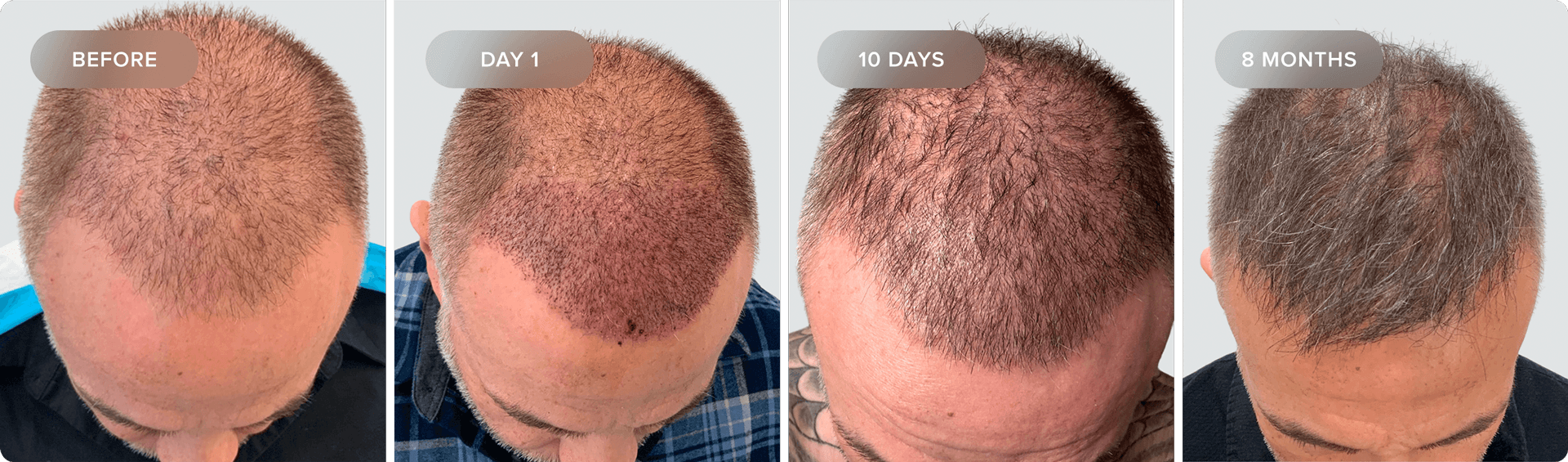 Shaveless_Recovery-DU