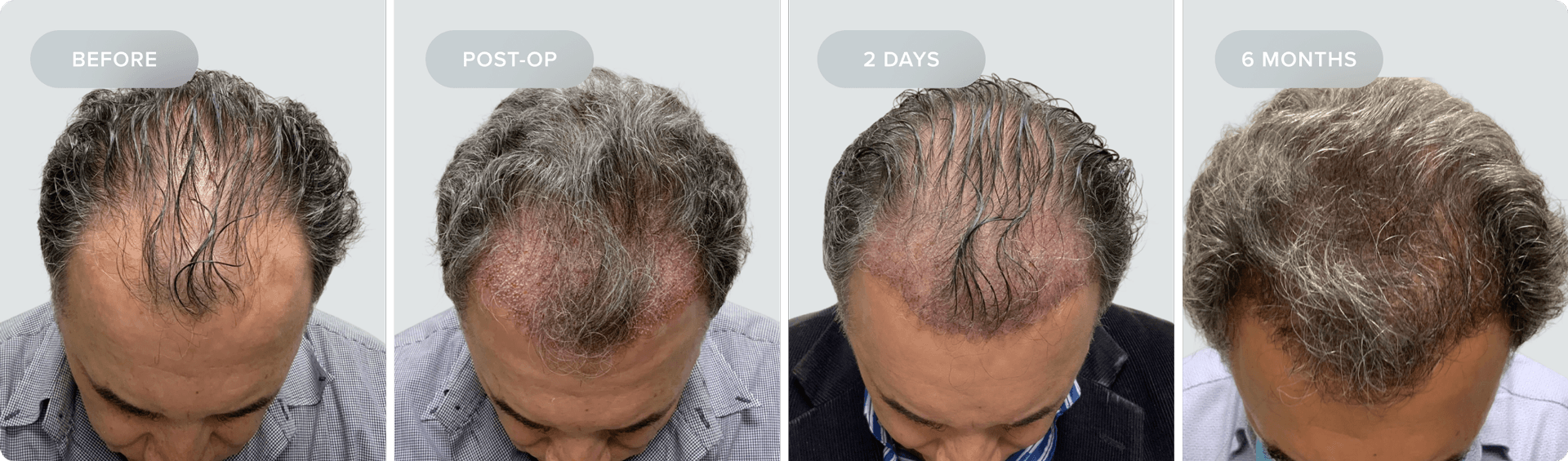 Shaveless_Recovery-NA