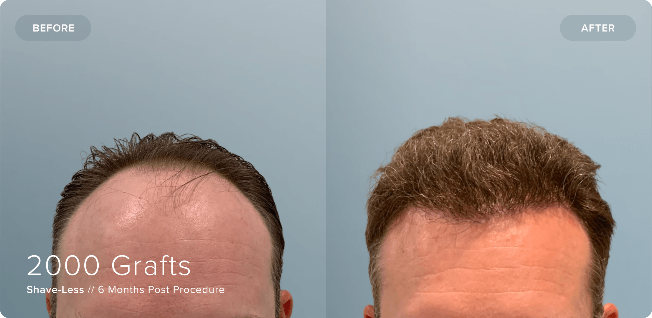 01 Shaveless_SW_Results