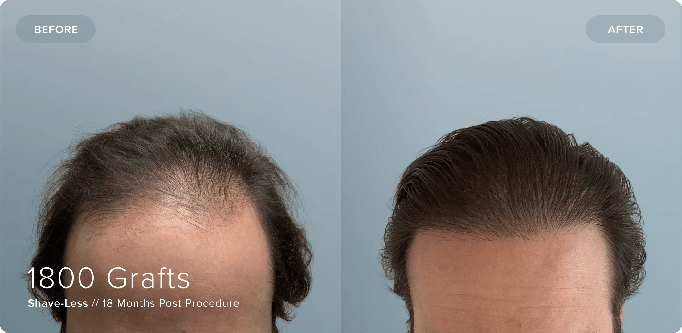 02 Shaveless_JL_Results