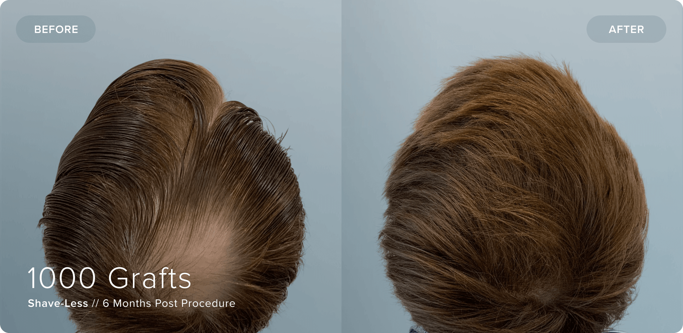 03 Shaveless_RS_Results