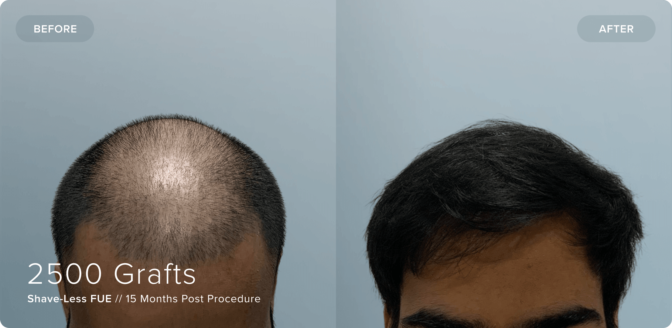 05 Shaveless_VR_Results