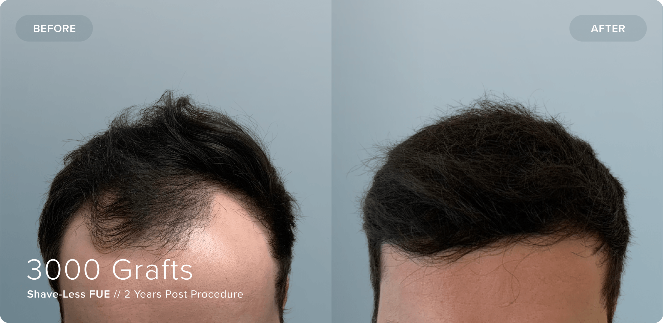 07 Shaveless_BL_Results