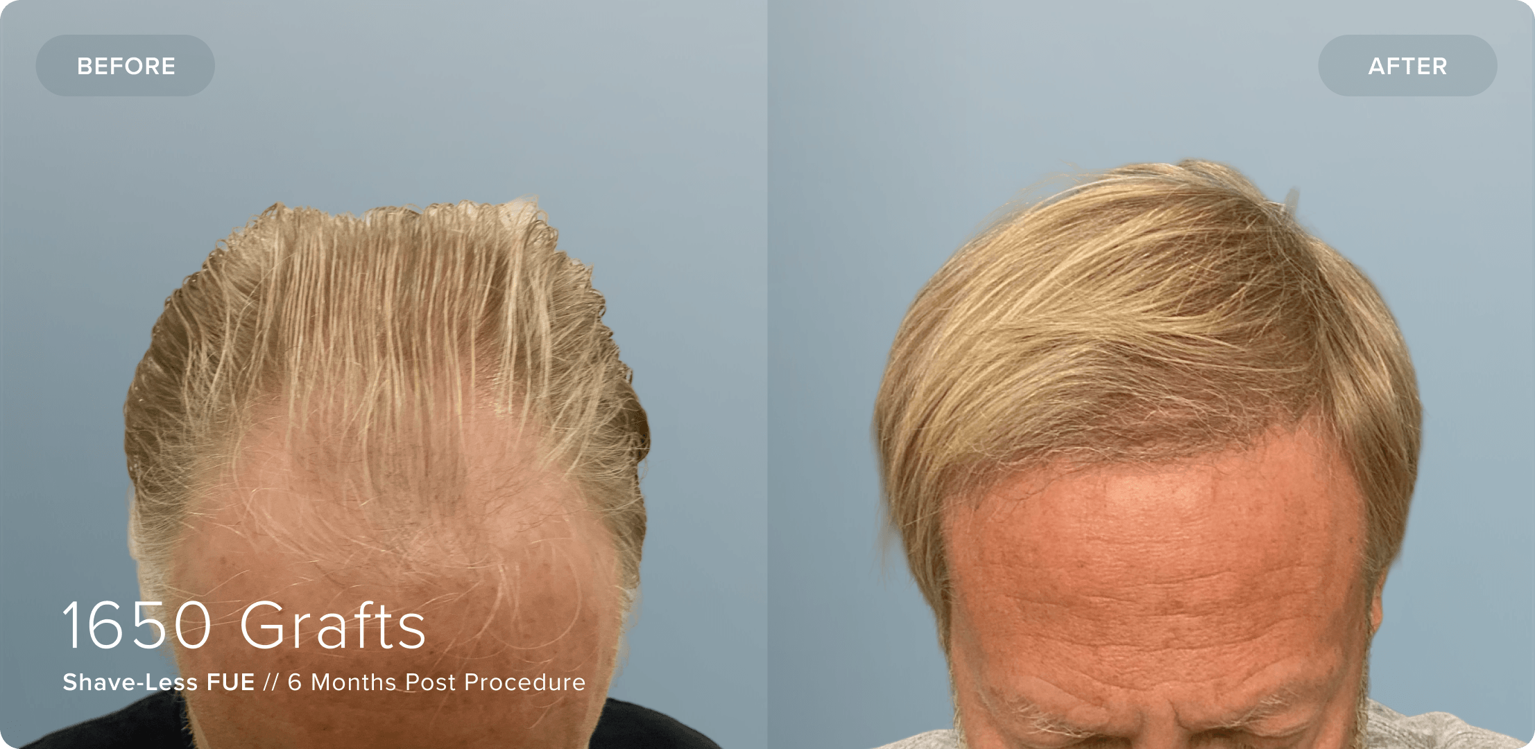 08 Shaveless_PD_Results