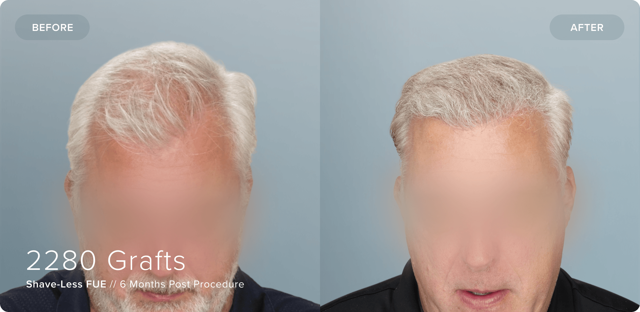 09 Shaveless_RC_Results