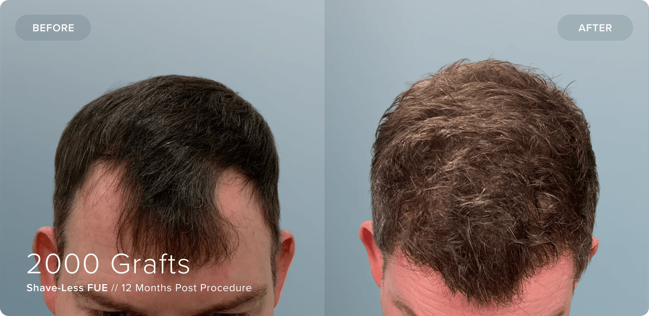 10 Shaveless_BC_Results