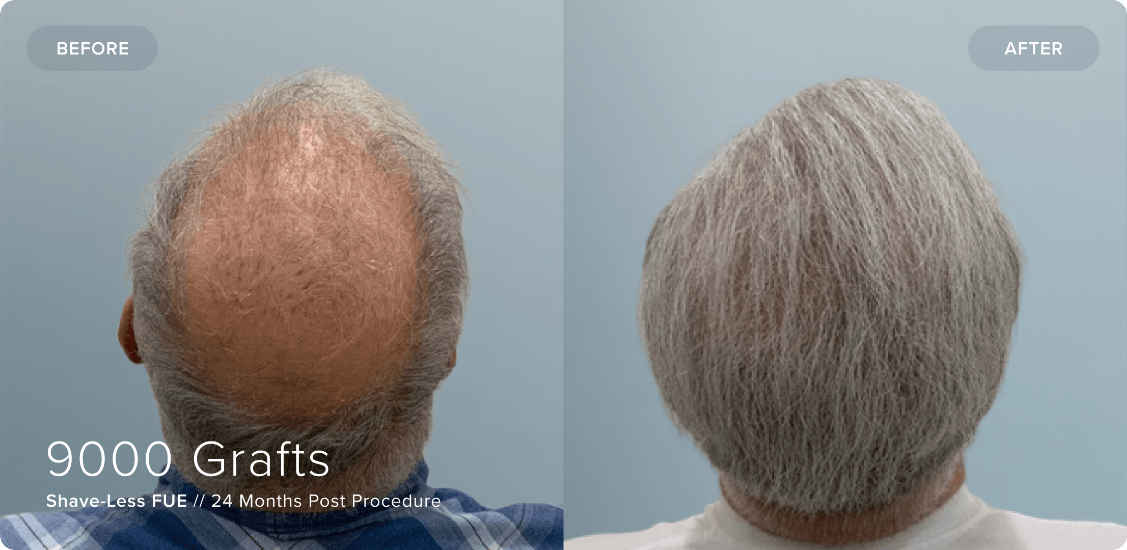 13 Shaveless_RB_Results
