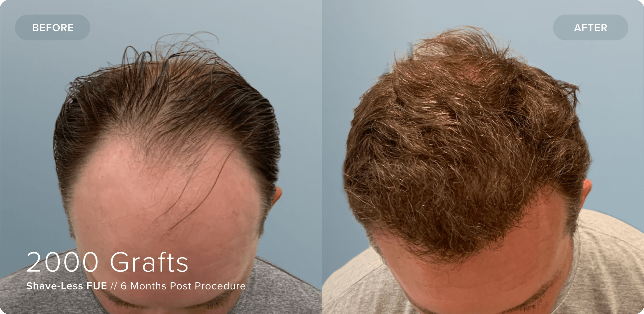 14 Shaveless_SW_Results-Alt