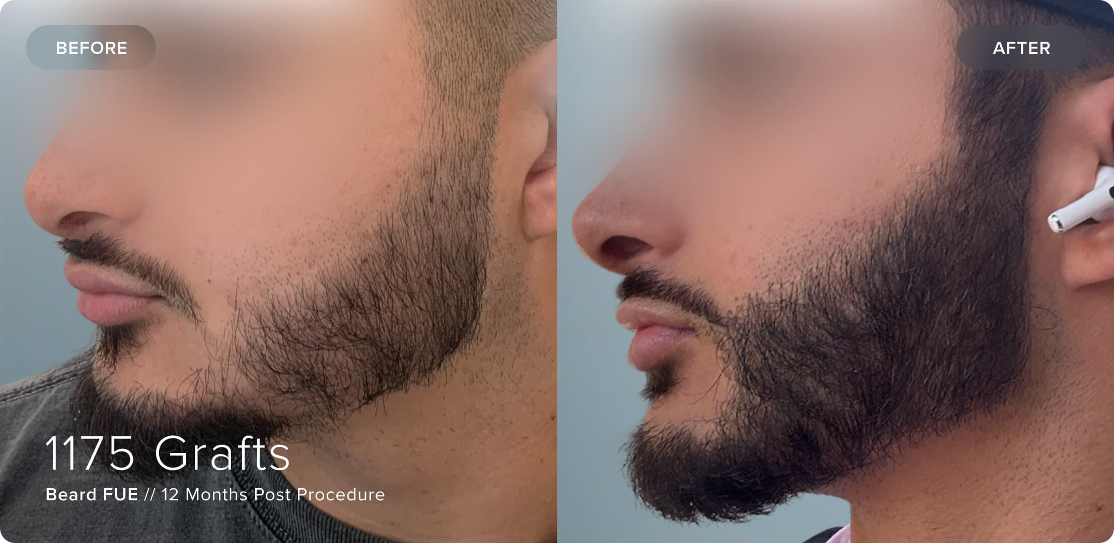 Beard_BK_Results