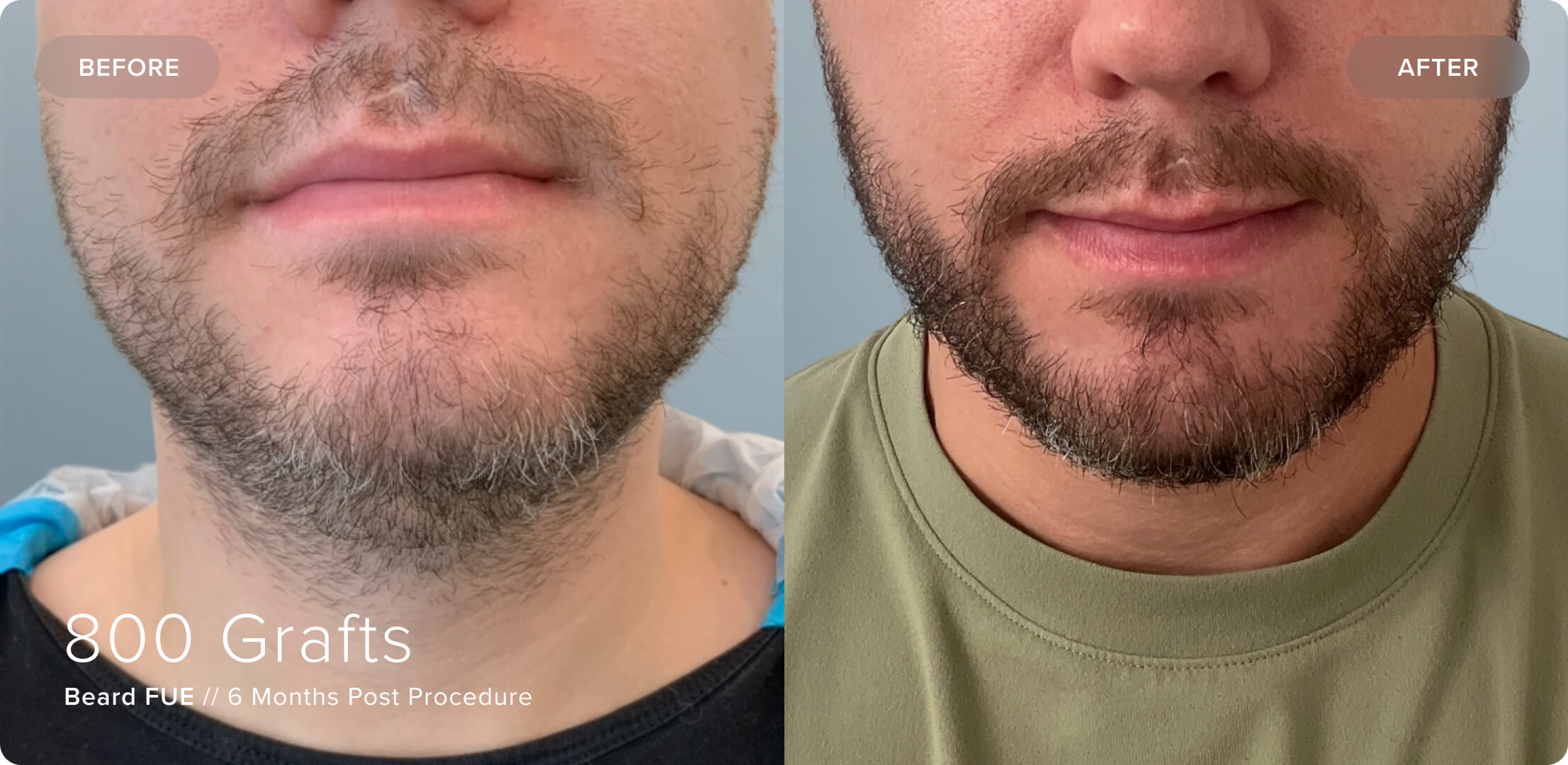 Beard_JC_Results-1