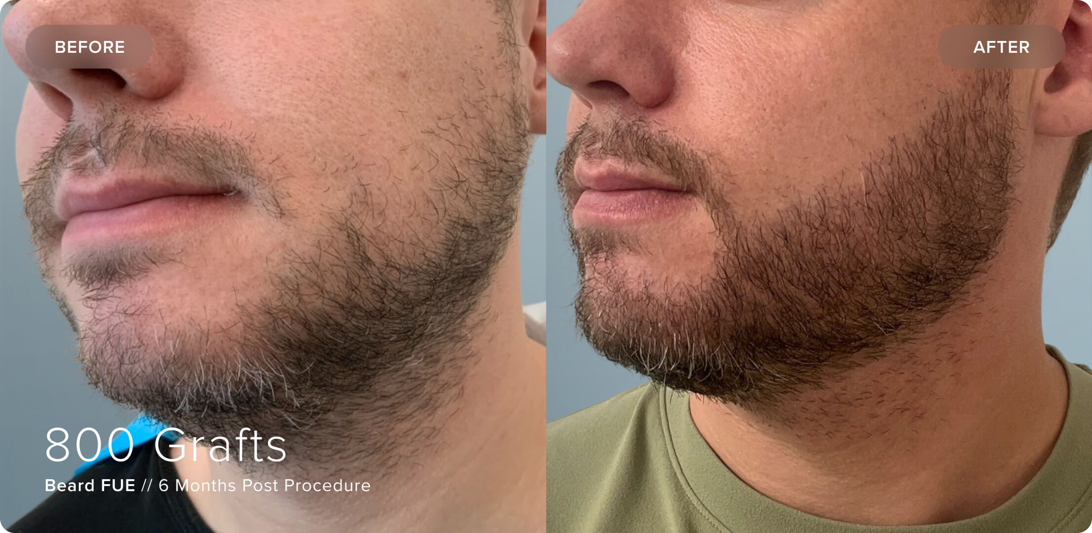 Beard_JC_Results