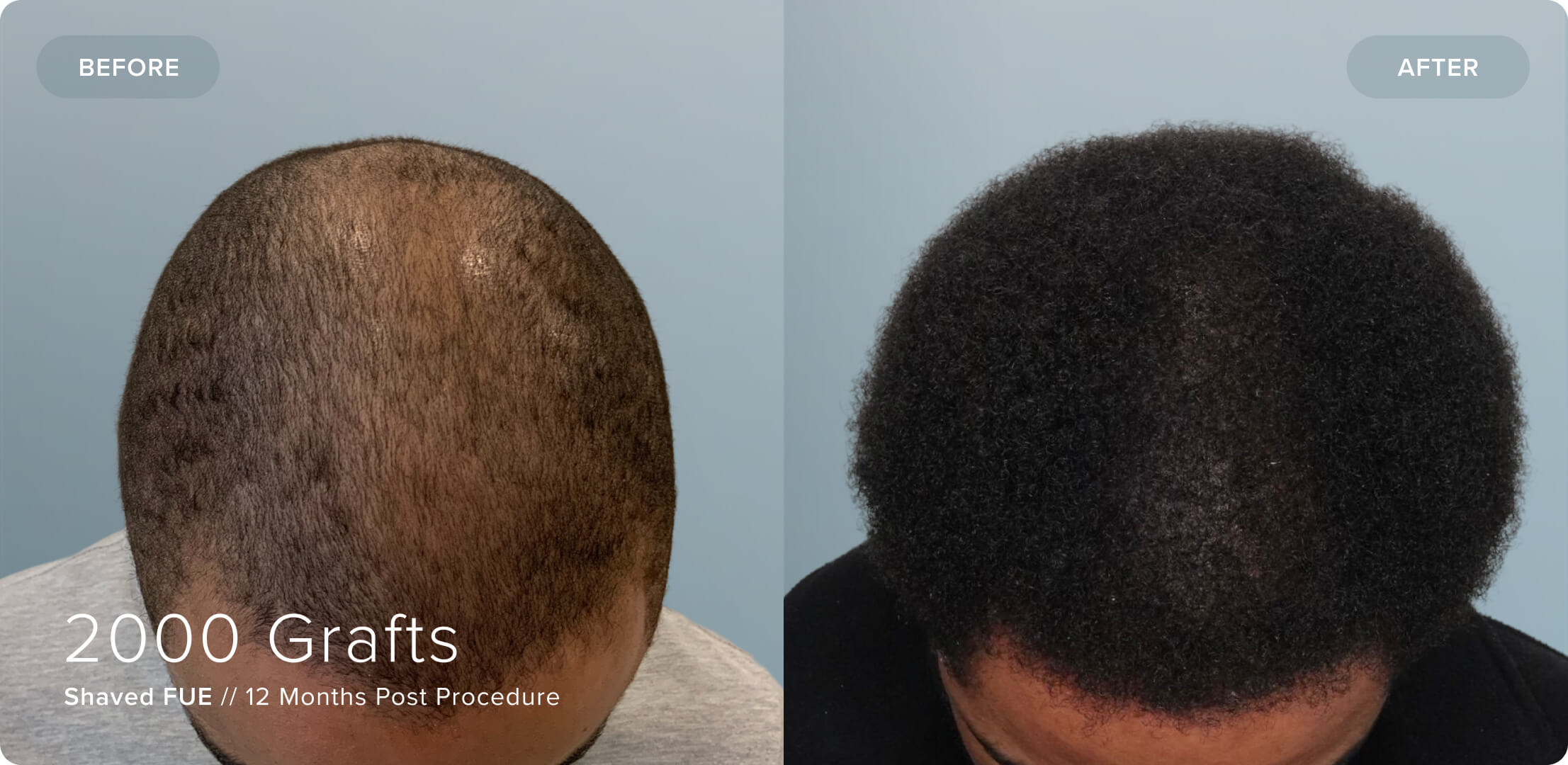 Shaved_AP_Results