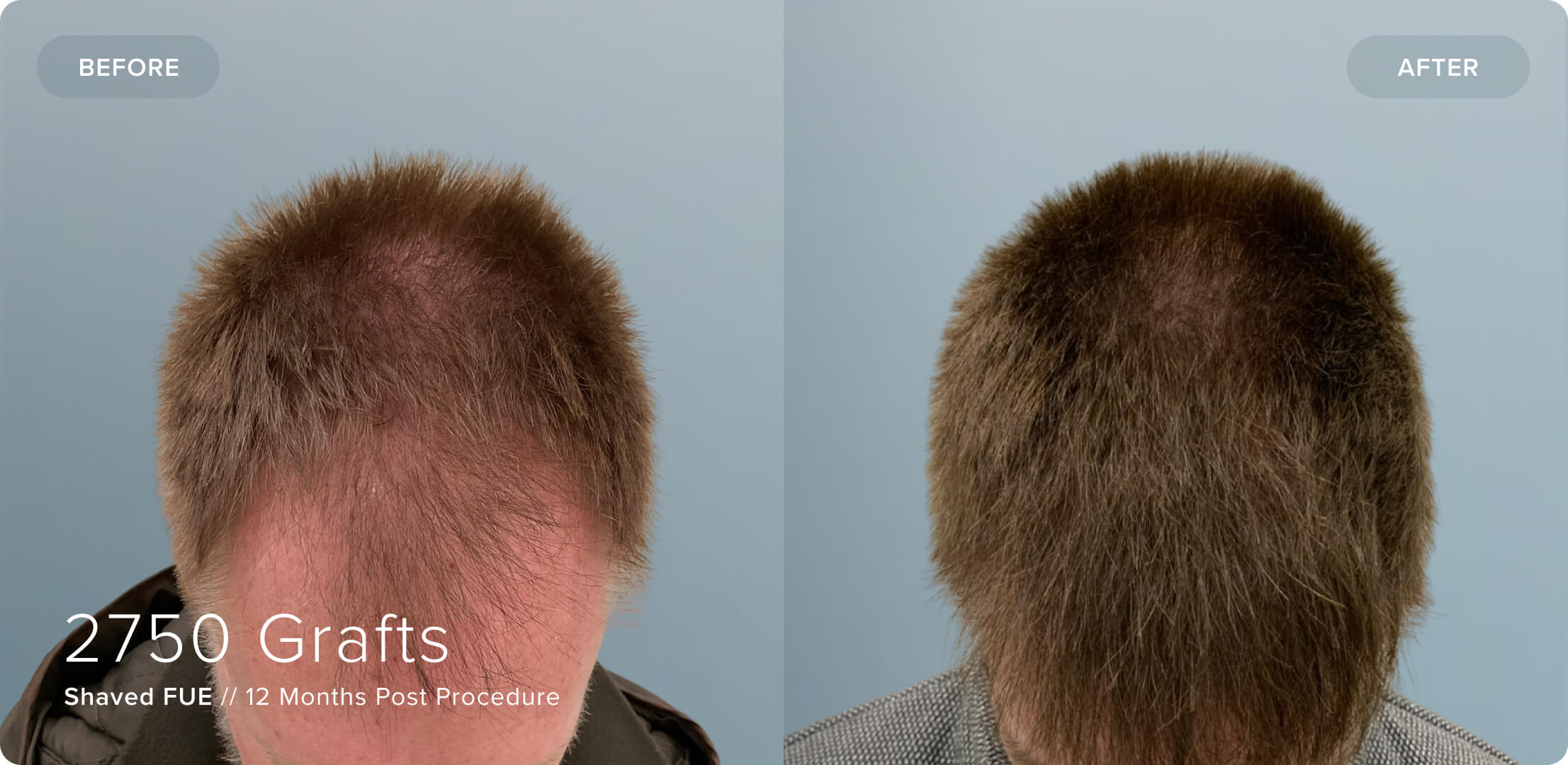 Shaved_AW_Results