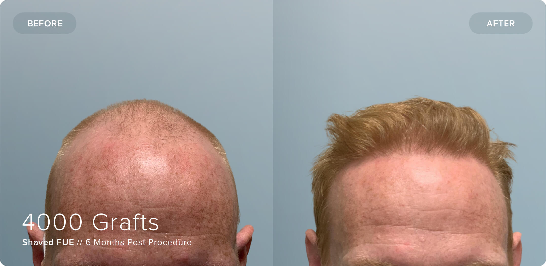 Shaved_JC_Results