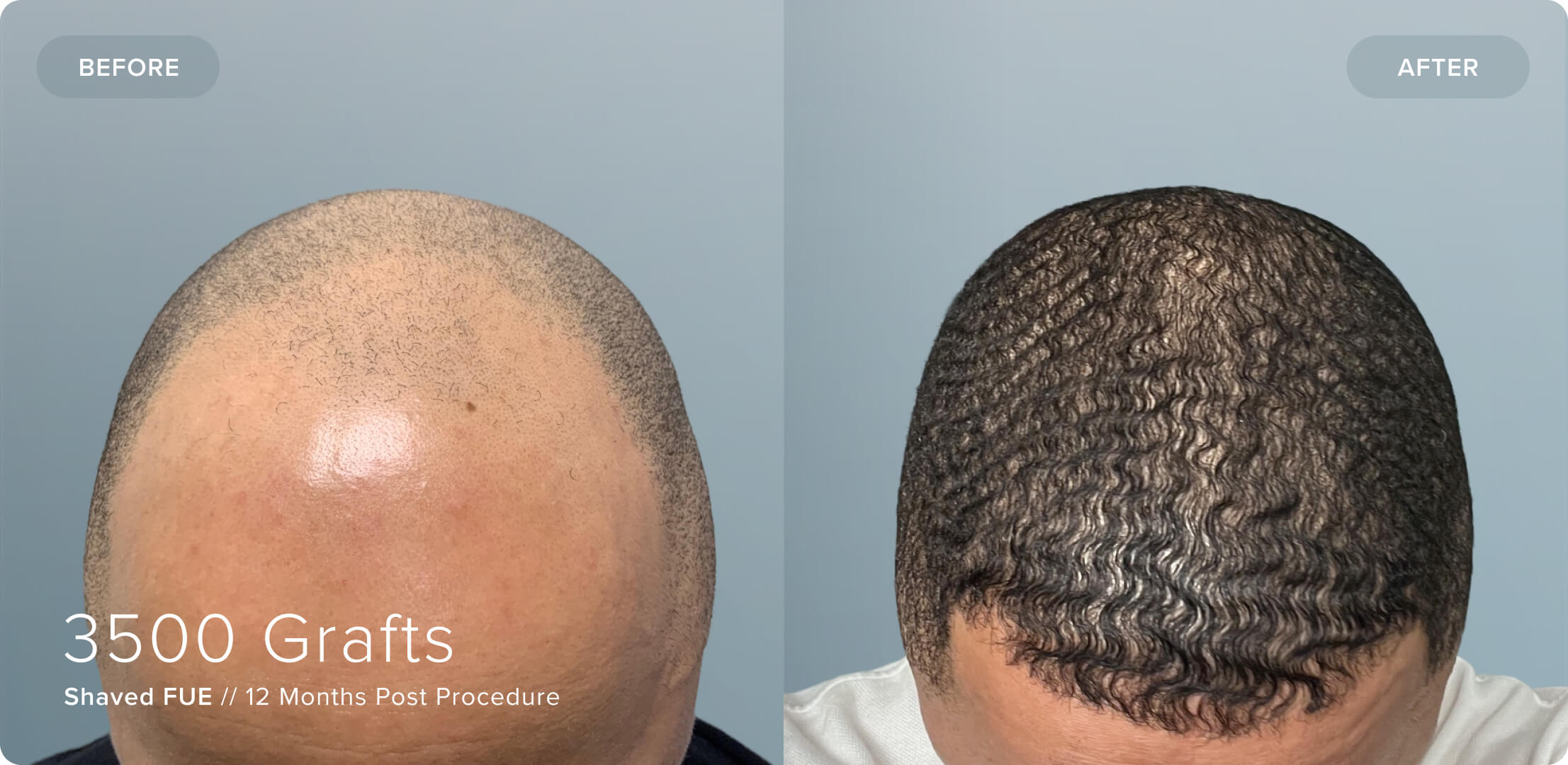 Shaved_TW_Results