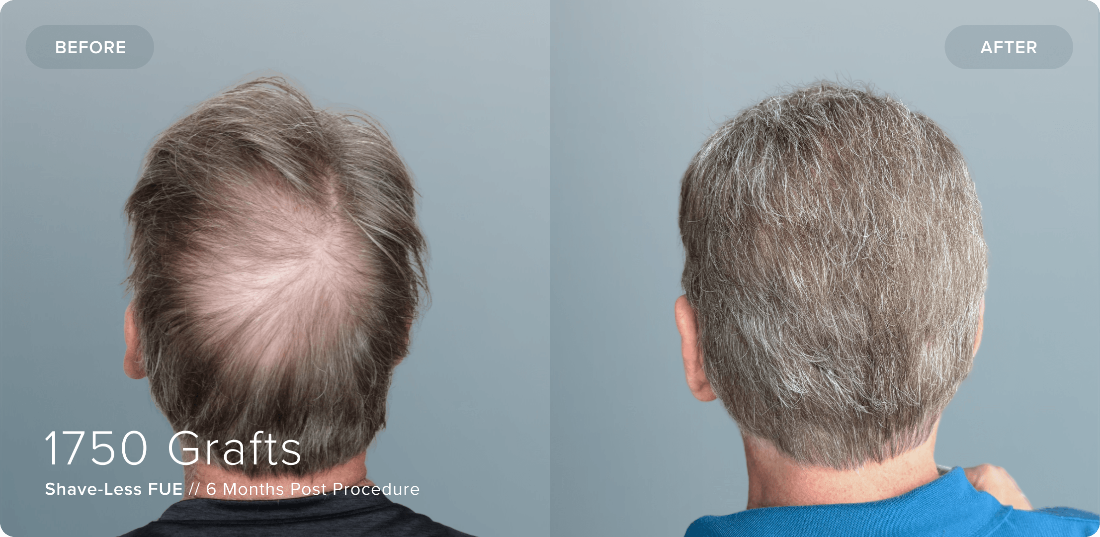Shaveless_SD_Results